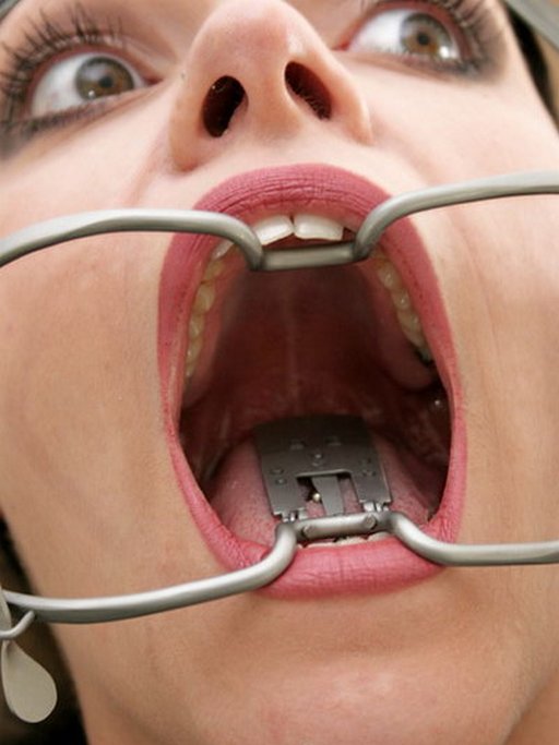 mouth stretched wide with dental gag