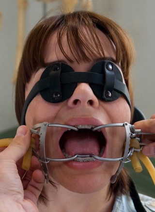 kinky dentist mouth gag