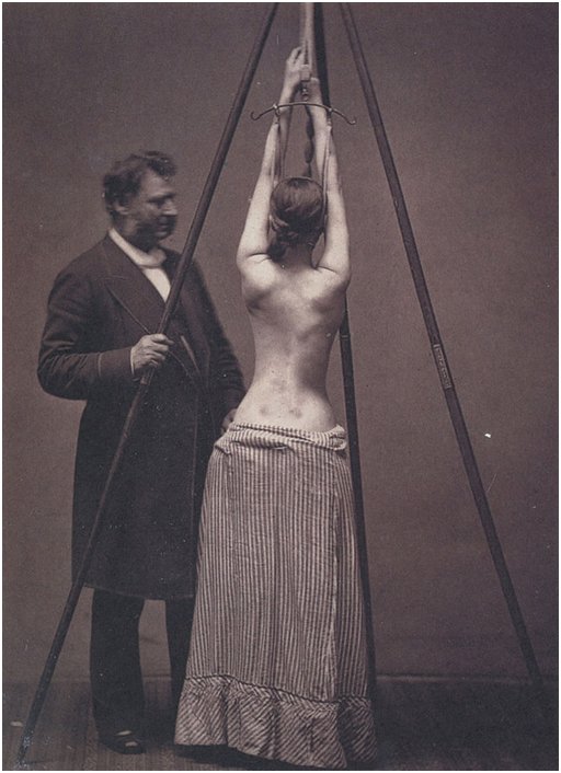 bondage scoliosis treatment