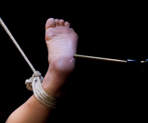 zapping her foot with the violet wand copper rod attachment